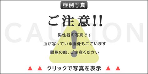 亀頭増大 銀座|亀頭増大術 亀頭増大術